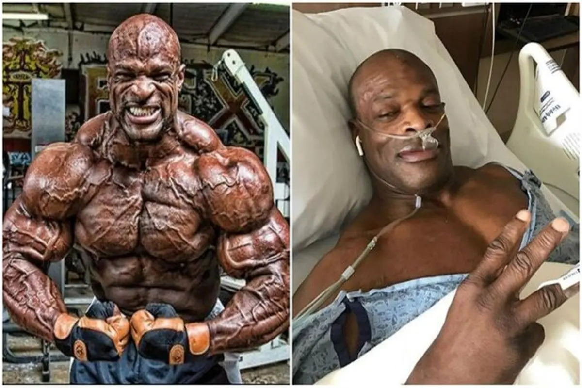 اسطوره پرورش اندام جهان در بخش مراقبت های ویژه22