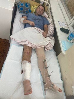 ایگور چروینسکی دچار مجروحیت جنگی شد23